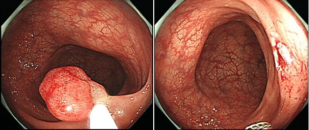21fzm5lb2hexiegtq8e7q2-16koscj85.jpg